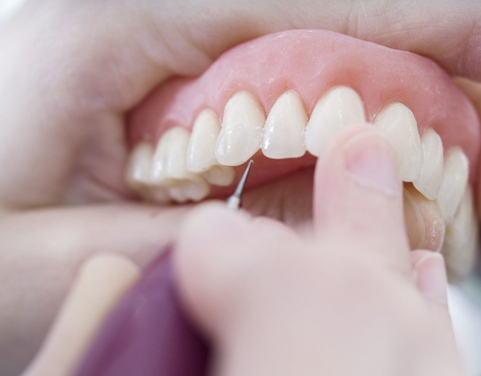 jak dbać o protezę zębów? dlaczego należy zdjąć protezę przed snem?