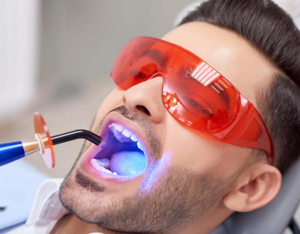 skuteczne wybielanie zębów w gabinecie stomatologicznym lampą